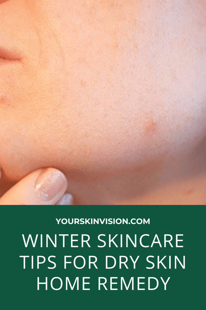 winter skincare tips for dry skin home remedy