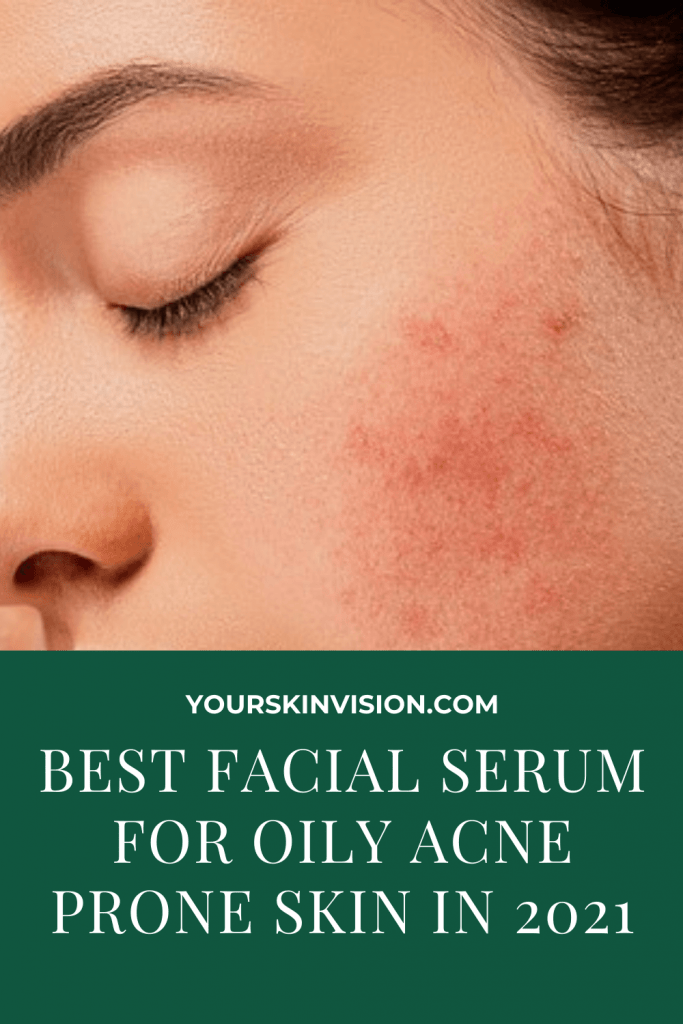 BEST FACIAL SERUM FOR OILY ACNE PRONE SKIN