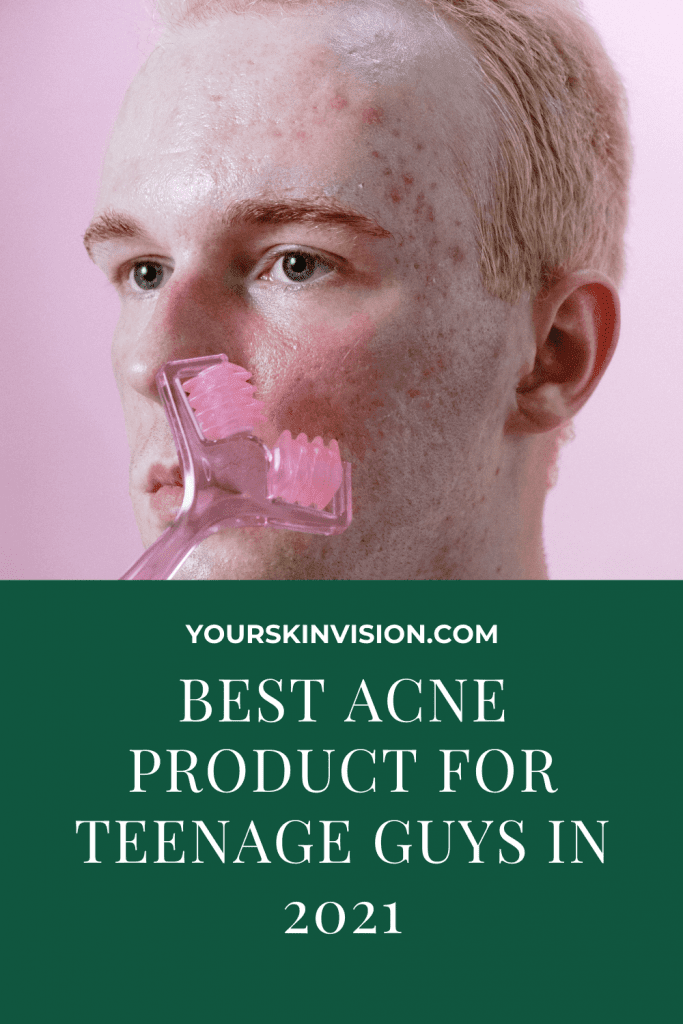 best acne product for teenage guys
