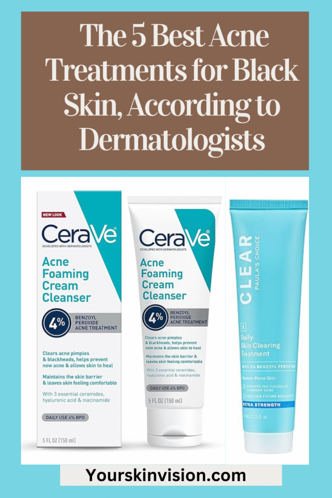 The 5 Best Acne Treatments for Black Skin, According to Dermatologists