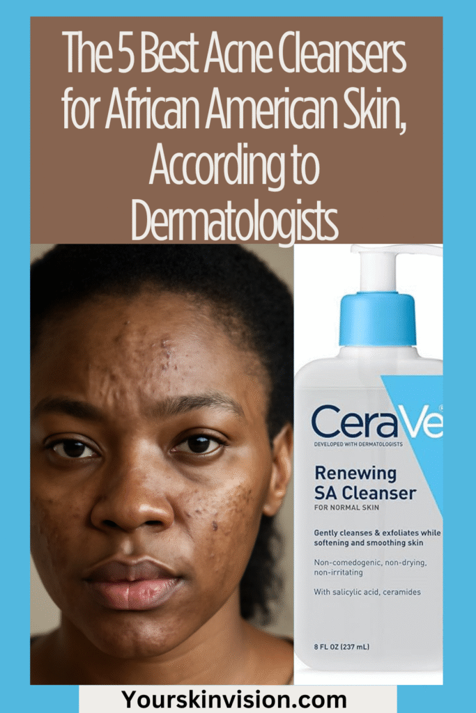 The 5 Best Acne Cleansers for African American Skin, According to Dermatologists