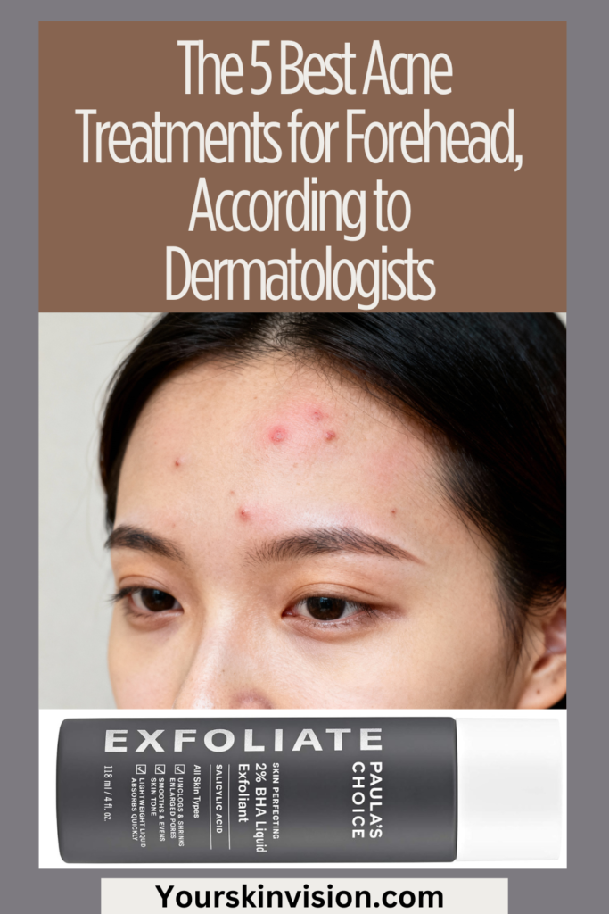 The 5 Best Acne Treatments for Forehead, According to Dermatologists