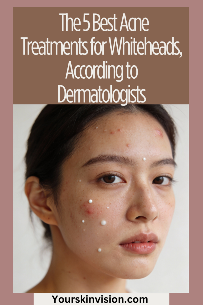 The 5 Best Acne Treatments for Whiteheads, According to Dermatologists
