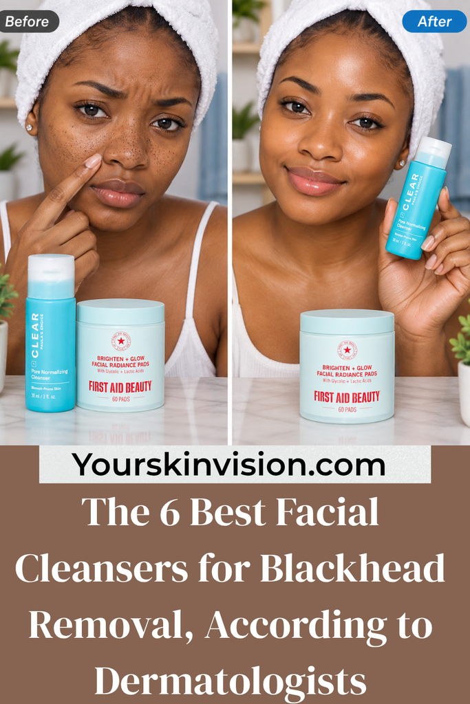 The 6 Best Facial Cleansers for Blackhead Removal, According to Dermatologists