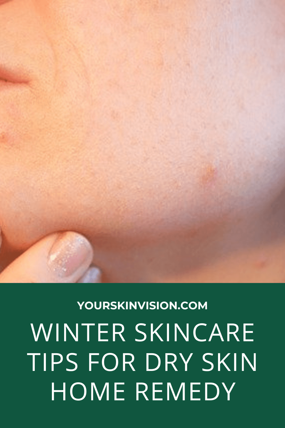 winter-skincare-tips-for-dry-skin-home-remedies-site