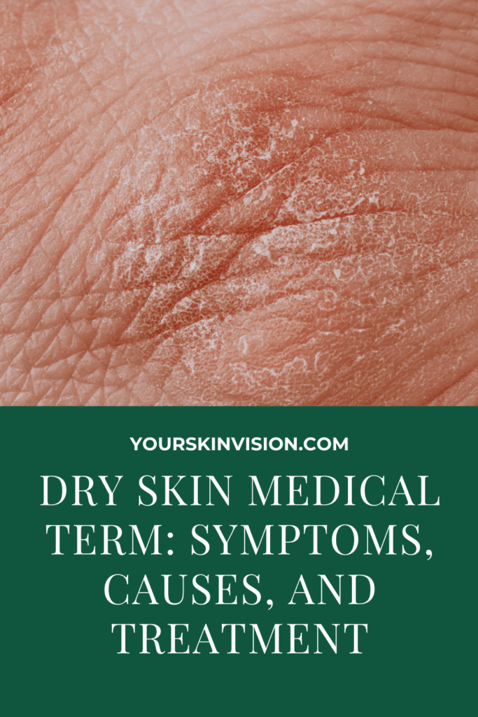 Dry Skin Medical Term: Symptoms, Causes, And Treatment