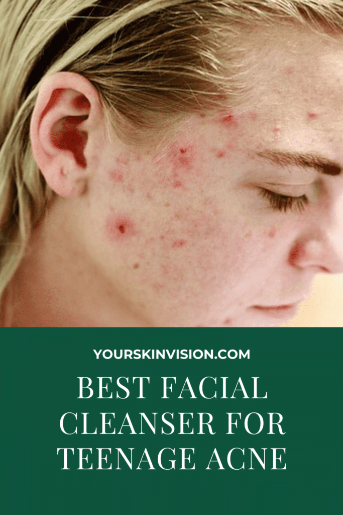 Best Facial Cleanser For Teenage Acne