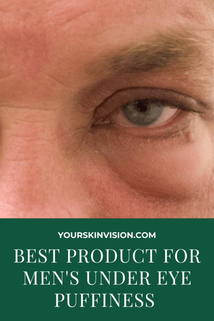 Best Product For Men's Under Eye Puffiness
