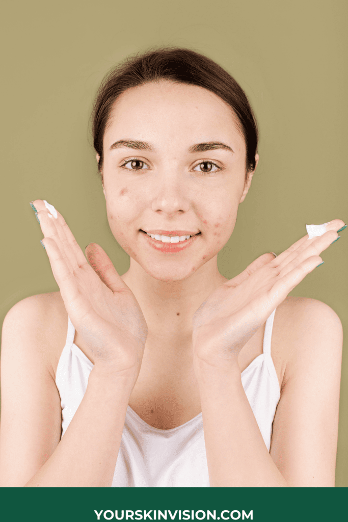 How Are Acne Medications Prescribed