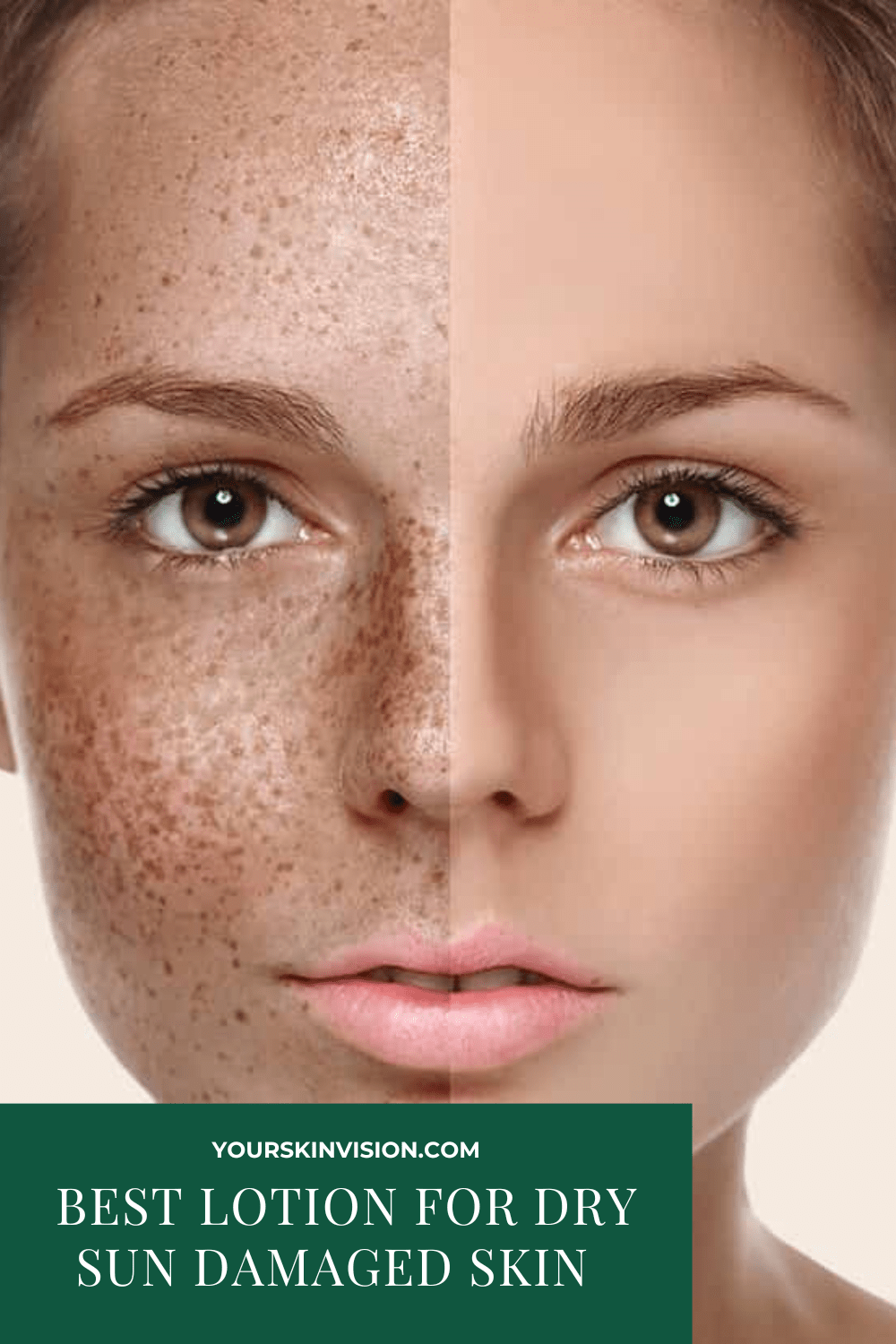 7 Best Lotion For Dry Sun Damaged Skin In 2024