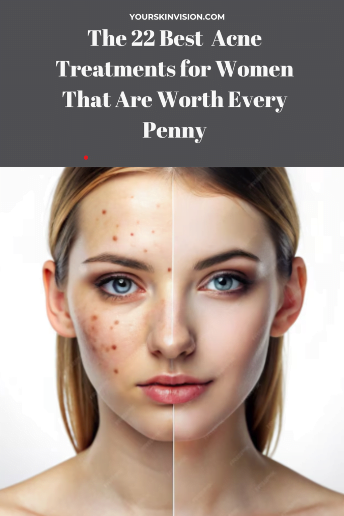 Image showcasing The 22 Best Acne Spot Treatments, Dermatologist-Approved - YourSkinVision